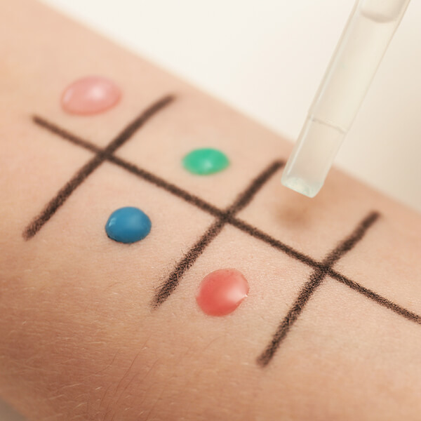 Alergologie - Asteri Medical Clinic